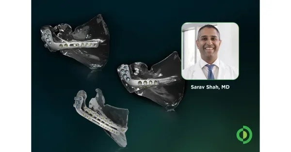 Local Orthopedic Surgeon First in Area to Use New Treatment Option for Complex Shoulder Surgery